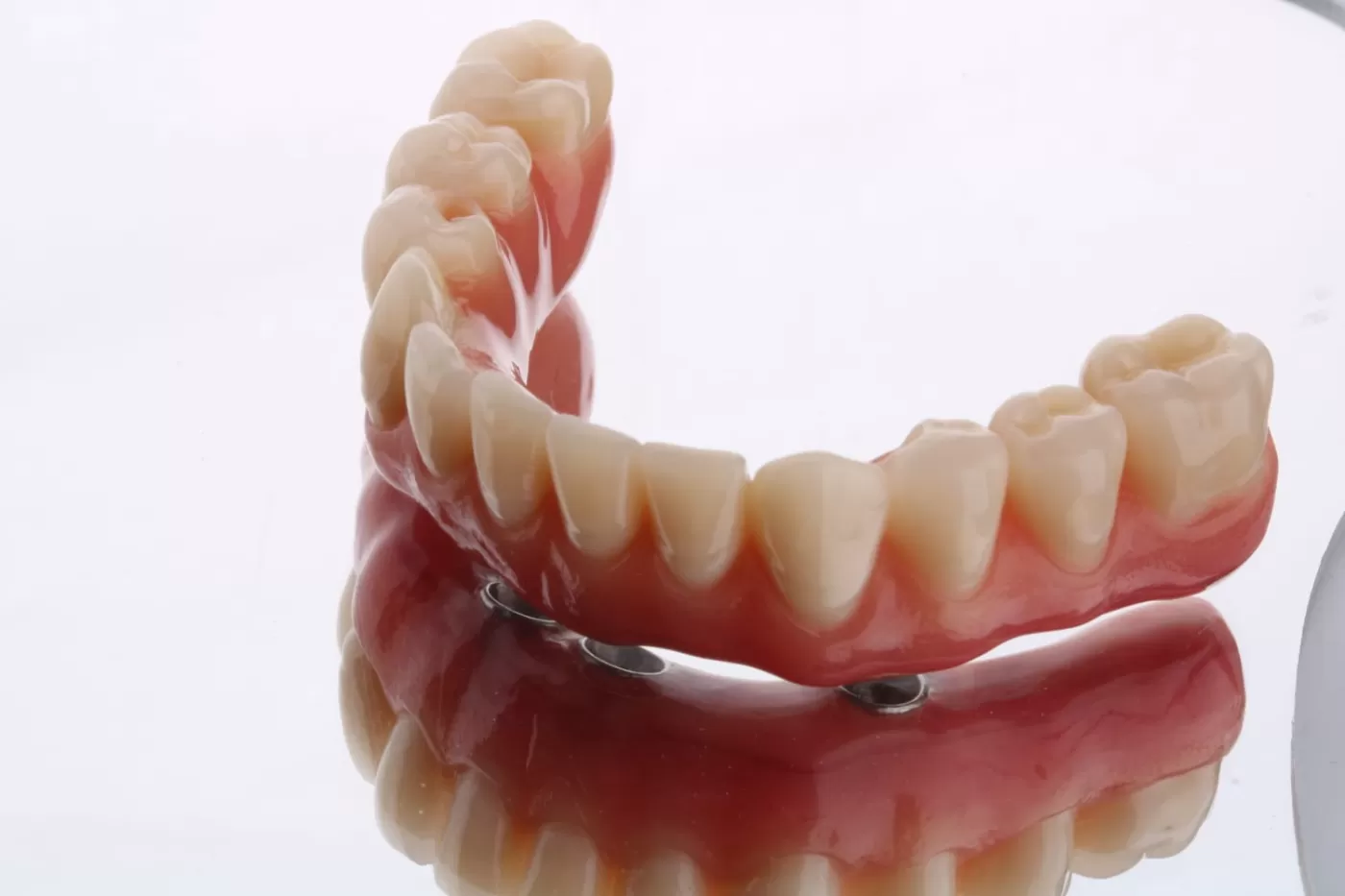 Prótese do tipo Protocolo